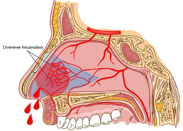 у ребенка идет кровь из носа
